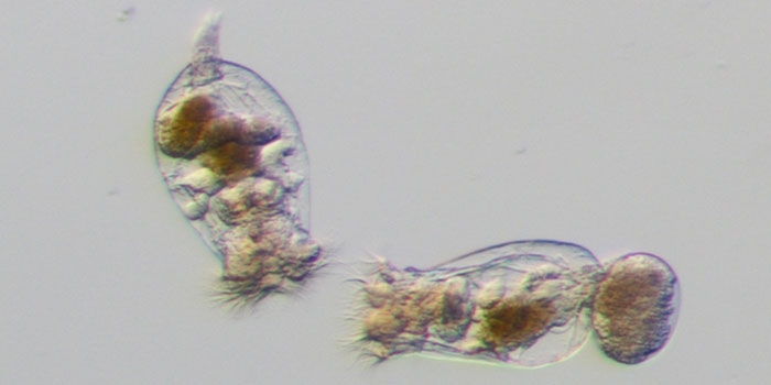 Rotifers as seen under a microscope​