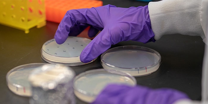 Yeast colonies are isolated in a petri dish.